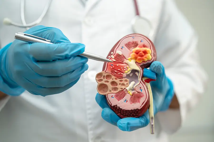 nephrologist explaining how kidneys work